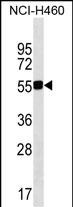 QRSL1 (N-term)
