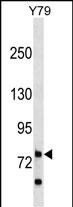 RHPN1