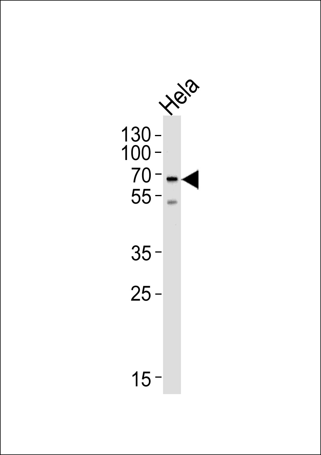 NAP1L2 (N-term)