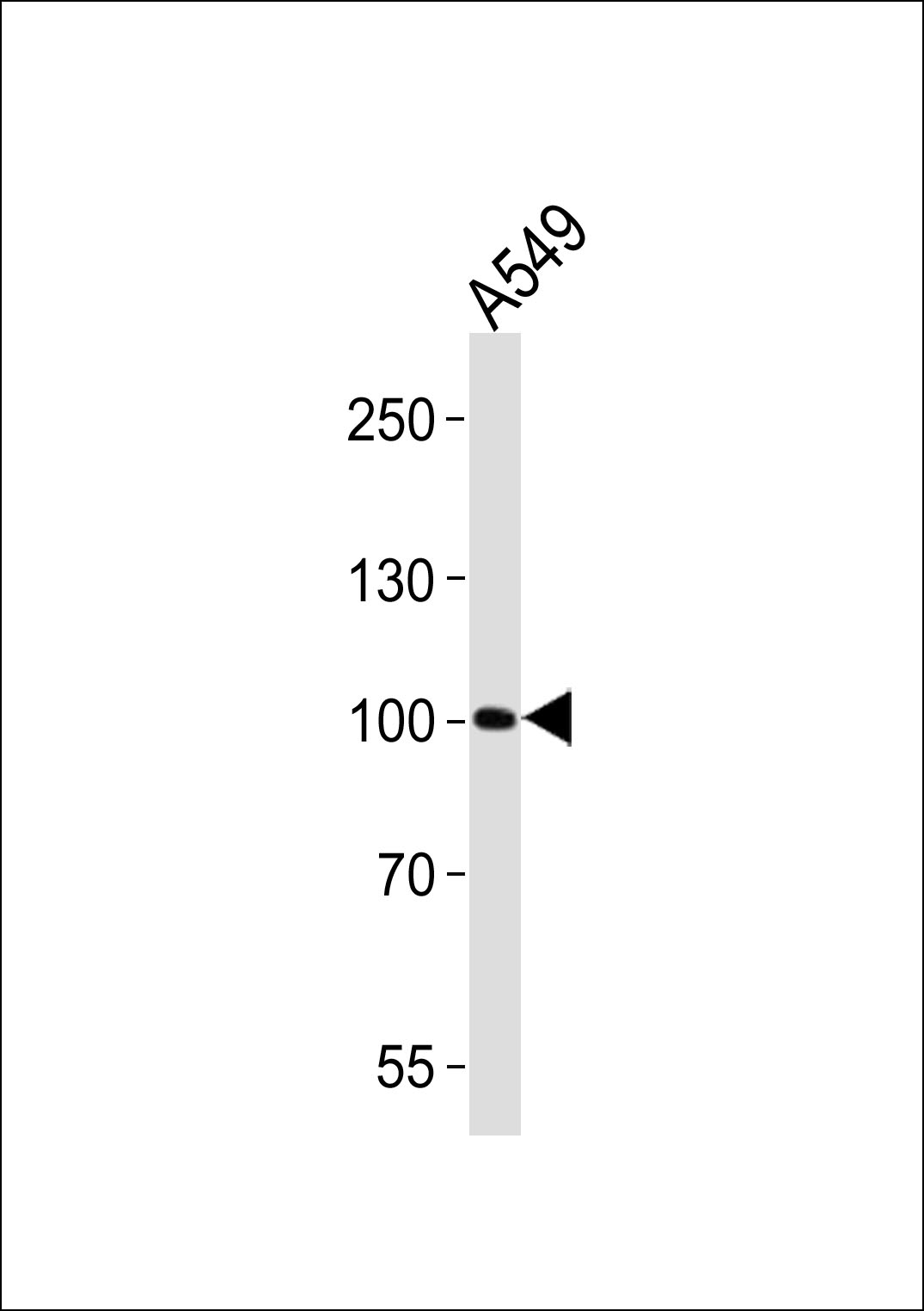 ZNF287 (N-term)