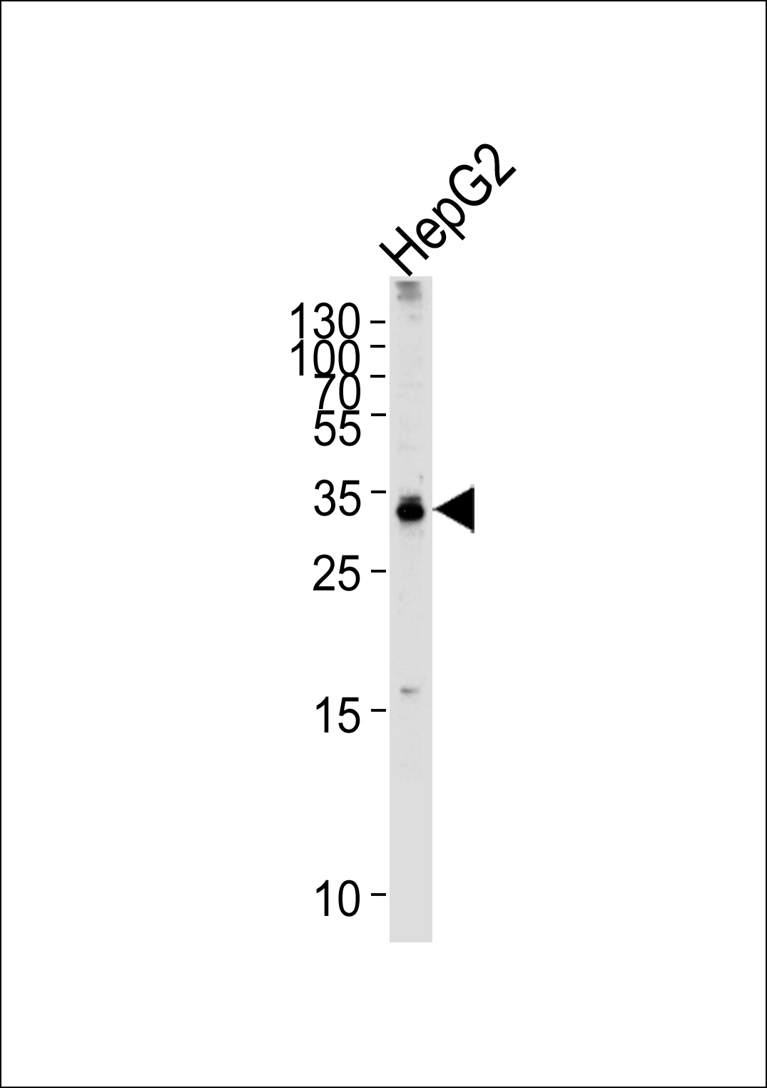 TCEAL2 (N-term)