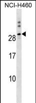 TTYH1 (N-term)