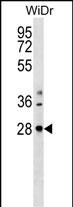 THAP10 (N-term)