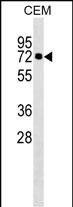 KLHL28