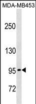 PCDHGA5 (N-term)