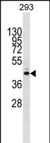 METTL2B (N-term)
