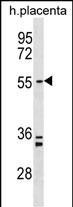 PAPD5 (N-term)