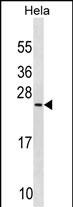 PRELID1 (N-term)