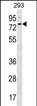 ZNF416