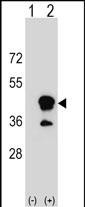 CD1B (N-term)