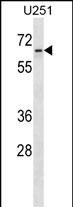 ZNF768 (N-term)