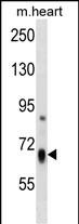 HBS1L