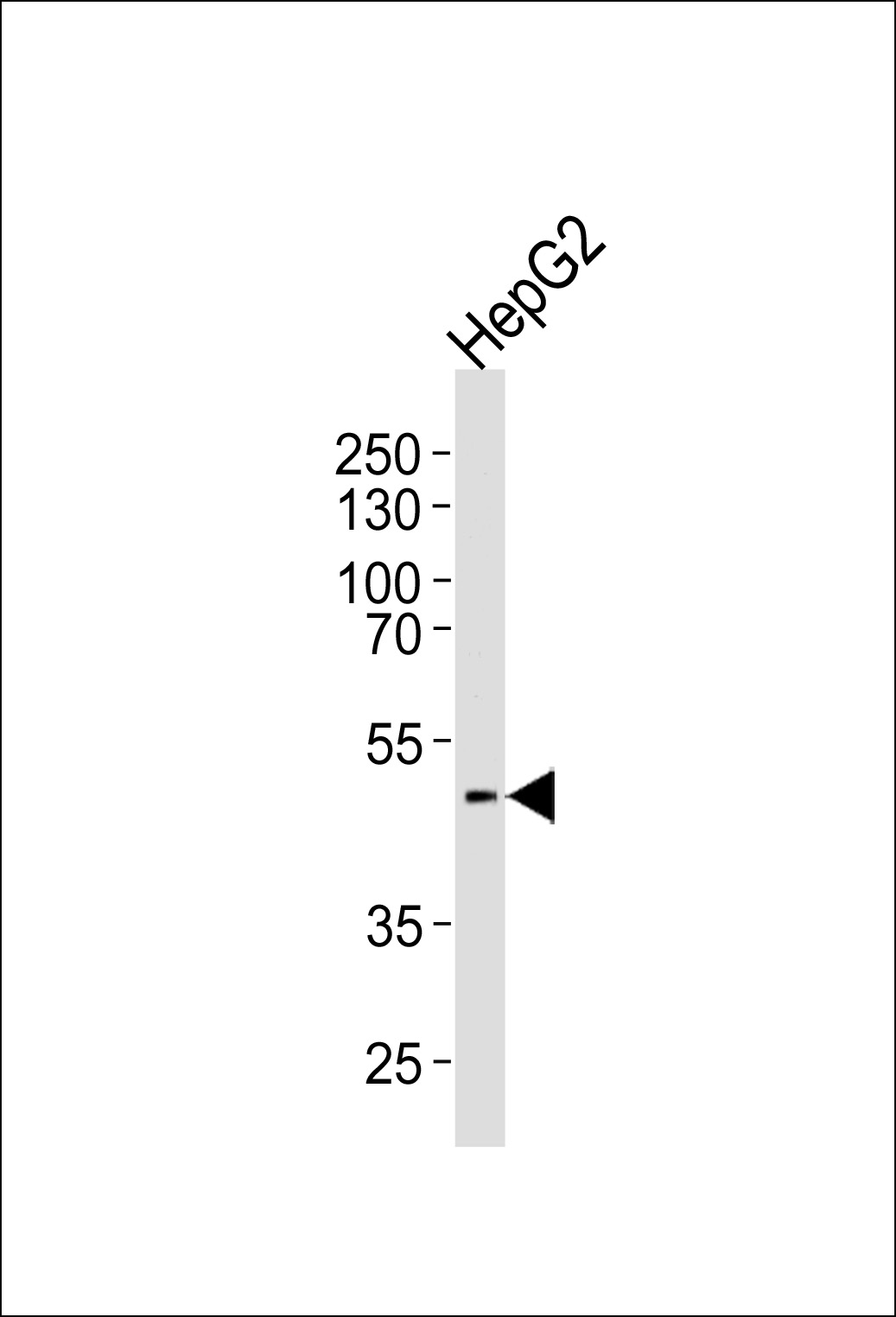 HHCM