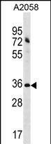 ACBD6 (N-term)