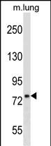 DNAJC10 (N-term)