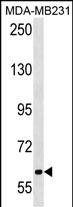 TRPC4AP (N-term)