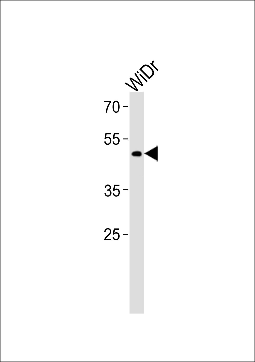 TFDP3 (N-term)