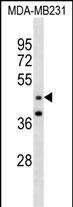 GRAMD3 (N-term )