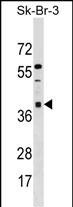 ARMC10 (N-term)