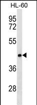 CLN8