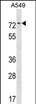 HKR1 (N-term)