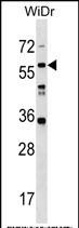 LRRC14B (N-term)