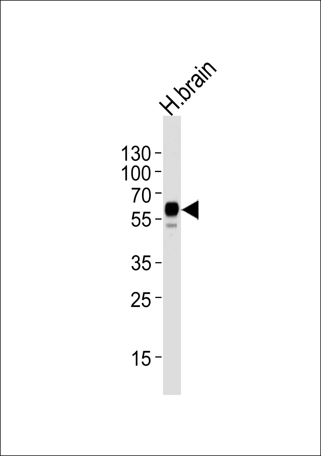 LRRTM2