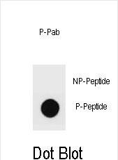 Phospho-mouse ERBB2(S999)