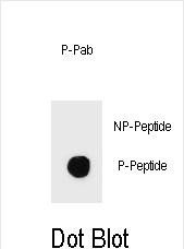 Phospho-IKKB(S466)