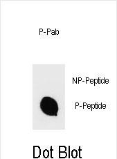 Phospho-IKKB(S670)