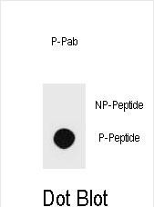 Phospho-PTEN(S229)