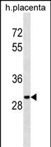 OR5B12