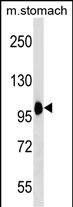 Rabbit Polyclonal Antibody to COPB2