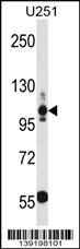 THBS3 (N-term)