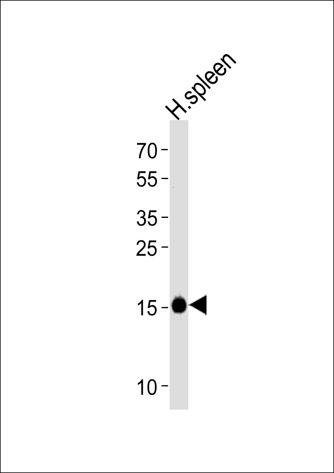 RNASE2
