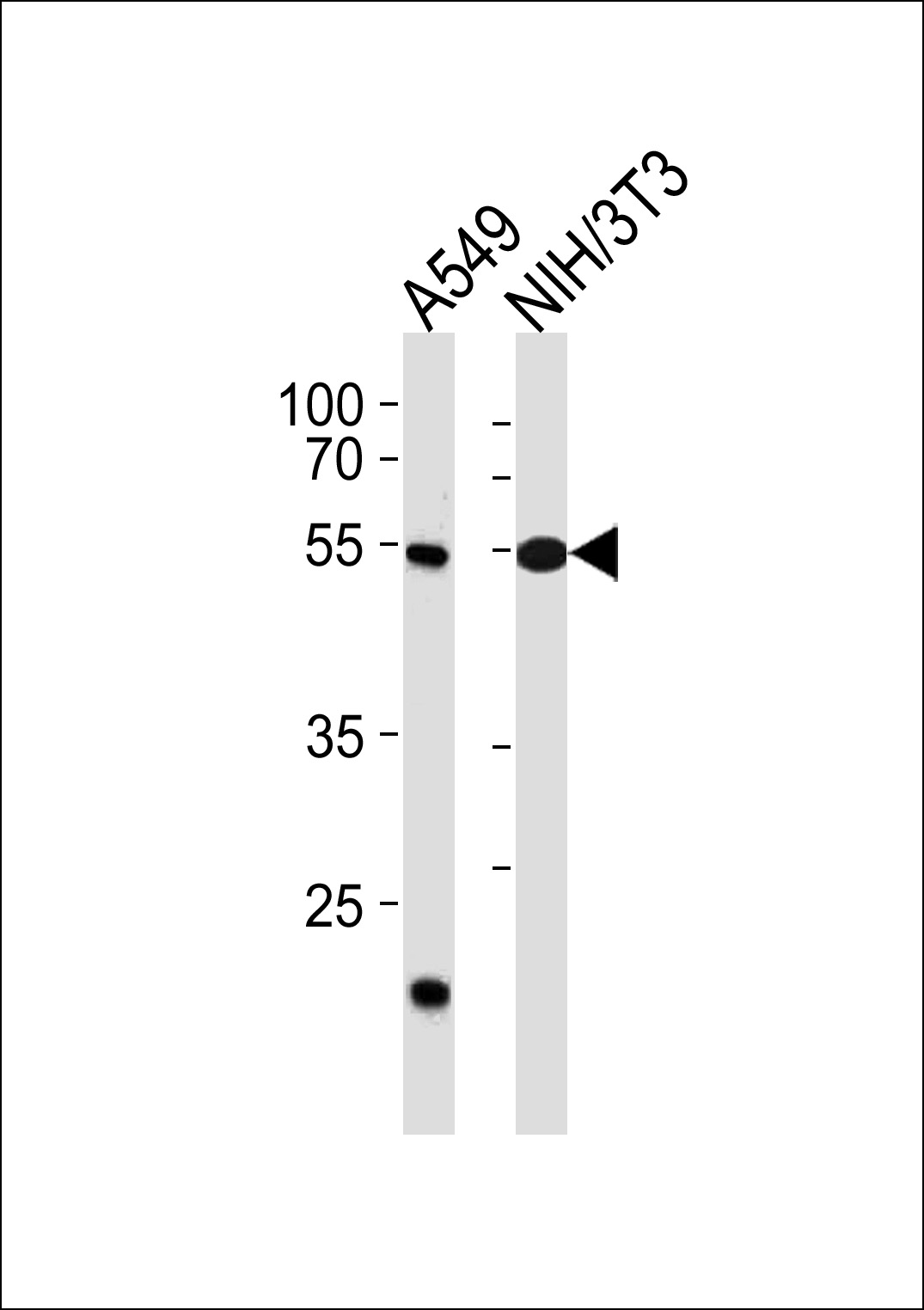 TBX4 (N-term)