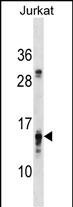 PFDN4 (N-term)