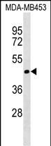 TIMM50 (N-term)