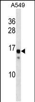 SSX11 (N-term)