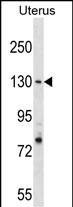 RFC1 (N-term)