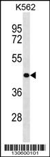 ZNF73 (N-term)