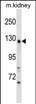 WDR64 (N-term)