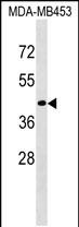 CD200R1L (N-term)