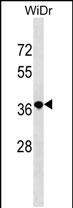 RN3L1