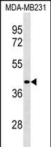 LRRC39 (N-term)