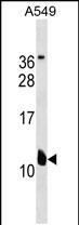 KCNE2