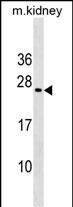 MIXL1