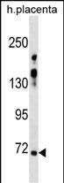 ZNF251 (N-term)