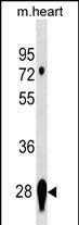 Rabbit Polyclonal Antibody to CAPNS2