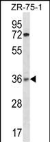 XRCC2(N-term)